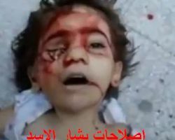 الرقص على الجراح