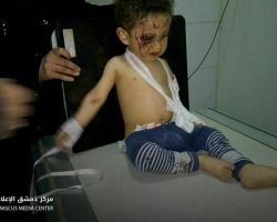هدوء نسبي في الغوطة: 7 ضحايا في حصيلة هي الأدنى منذ أسبوع