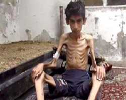 مضايا التي تموت جوعاً بصمت؟!