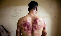 معتقل سابق يكشف عن وسيلة تعذيب جديدة في سجون الأسد