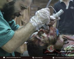 قصف مكثف على بلدات ريف دمشق، والثوار يردون باستهداف مواقع قوات الأسد