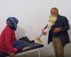  3700 سوري يحتاجون إلى أطراف صناعية في الرقة