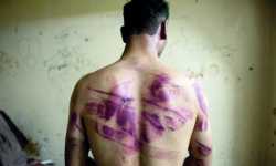 مقتل 19 شخصاً نتيجة التعذيب في سجون النظام خلال الشهر الماضي
