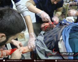 شهداء وجرحى في دوما بقصف مدفعي من قبل قوات النظام