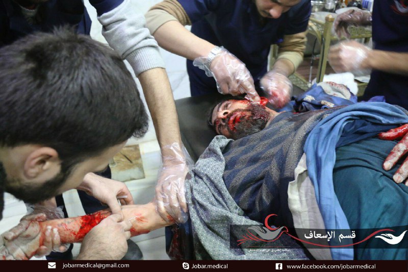 شهداء وجرحى في دوما بقصف مدفعي من قبل قوات النظام