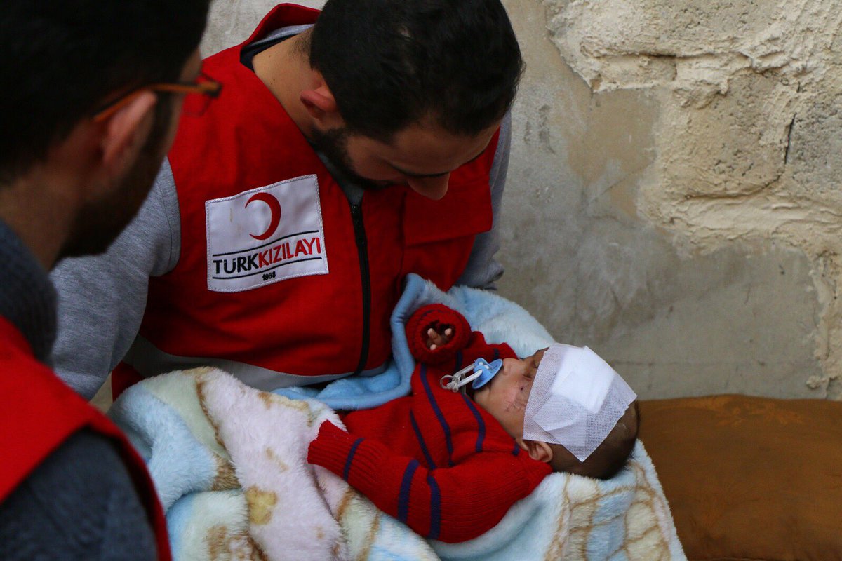 الهلال الأحمر التركي يصل إلى الطفل كريم في الغوطة المحاصرة