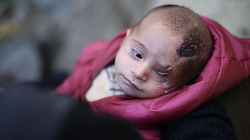 هكذا تم إنقاذ الرضيع كريم الذي اغتال النظام السوري عينه وأمه (شهادات)