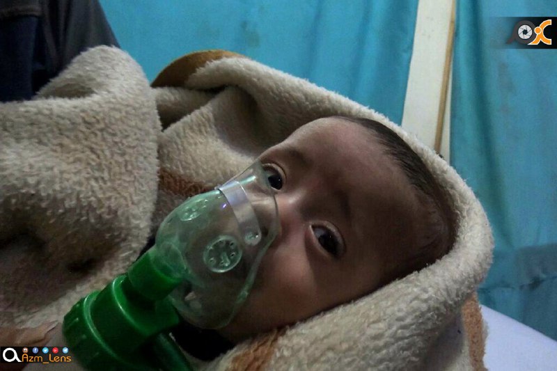 الكيماوي في الغوطة من جديد.. عشرات حالات الاختناق في قصف بالكلور السام على دوما