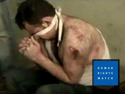 هيومن رايتس: 20 أسلوب تعذيب موثقا في معتقلات سوريا